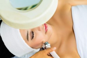 Tulsa Cosmetic Surgery Photofacials 1